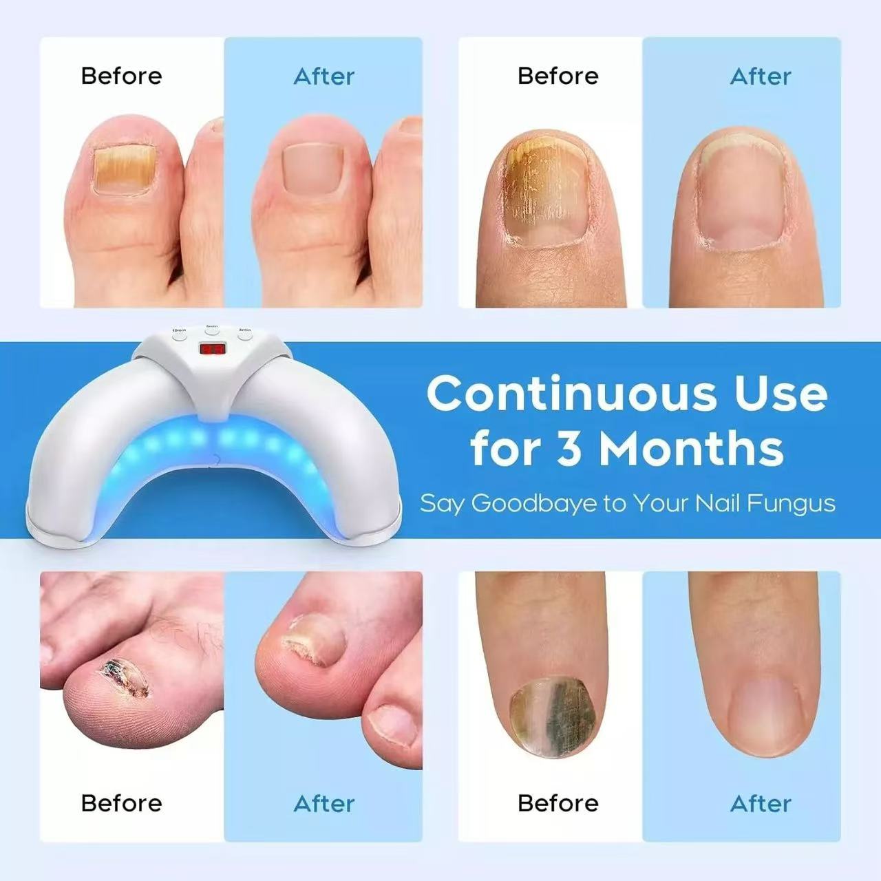 Kexi life-Your Path to Healthier-Looking Nails